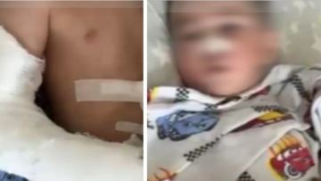 Жылқы таптаған: Ат жарысы кезінде зардап шеккен бүлдіршіннің жағдайы ауыр
