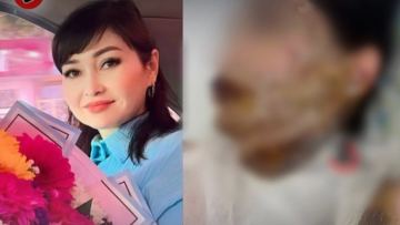 «Мен сені адам танымастай қылып тастаймын»: Шымкентте ер адам бұрынғы әйеліне қышқыл төккен