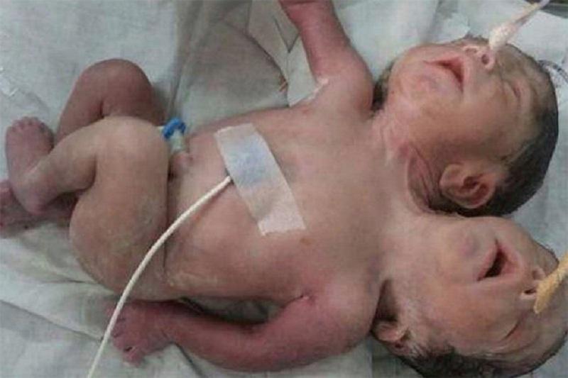 ٷندٸستاندا ەكٸ باستى, ٷش قولدى سەبي دٷنيەگە كەلدٸ