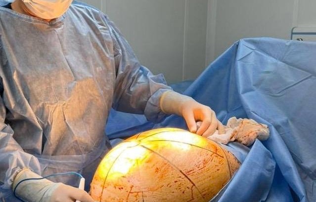 Almatyda dárigerler 25 kelilik alyp isikti sátti alyp tastady