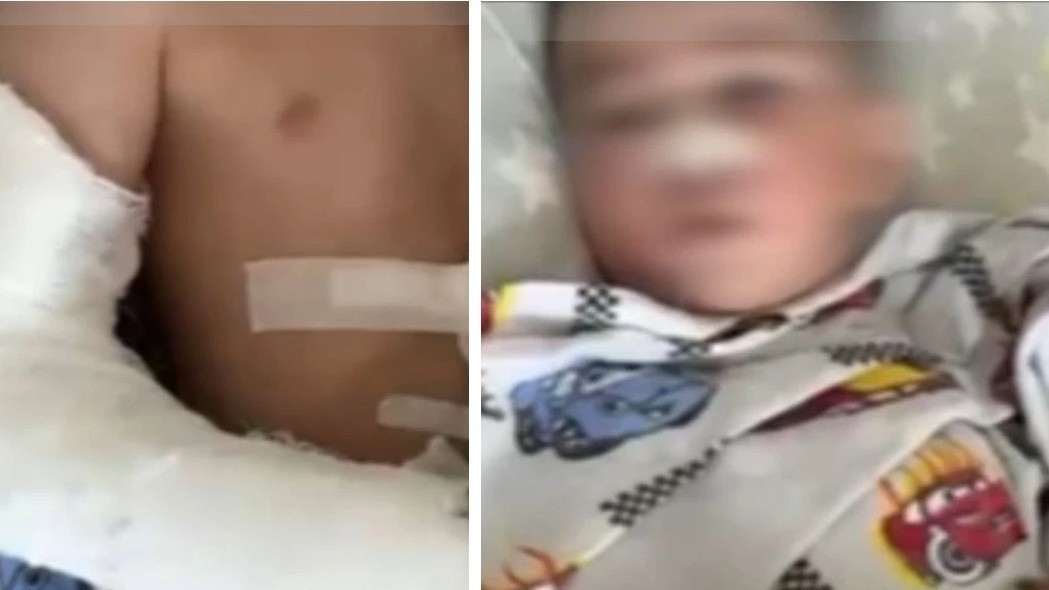 جىلقى تاپتاعان: ات جارىسى كەزٸندە زارداپ شەككەن بٷلدٸرشٸننٸڭ جاعدايى اۋىر