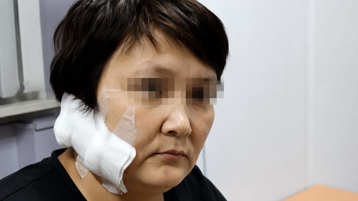 ШҚО-да ер адам бұрынғы әйеліне шабуыл жасады